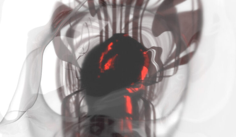 Lee más sobre el artículo Interstitial Fictions in BERROCAL